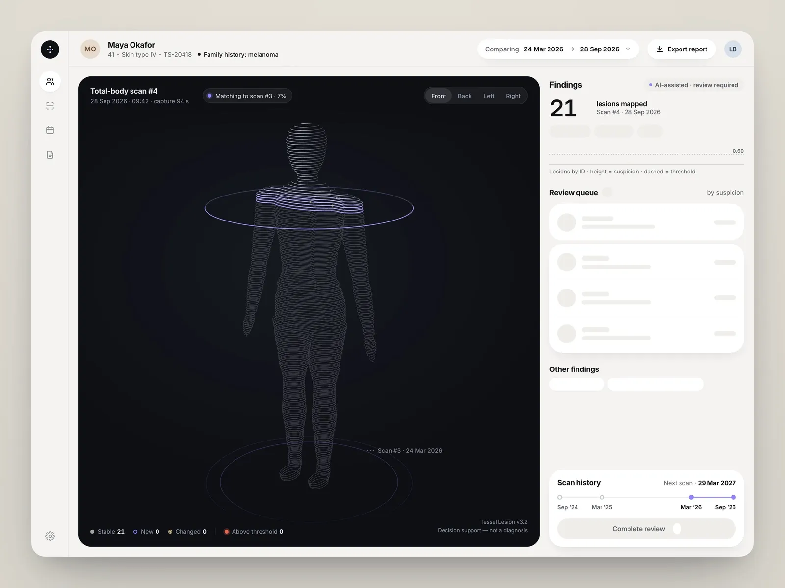 Desktop dashboard for dermatology skin scans showing a wireframe total-body 3D model, a patient header, a findings counter, a review queue and a scan history timeline.